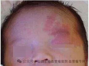 7acb52d336795833fecd2530b542dc59.jpg