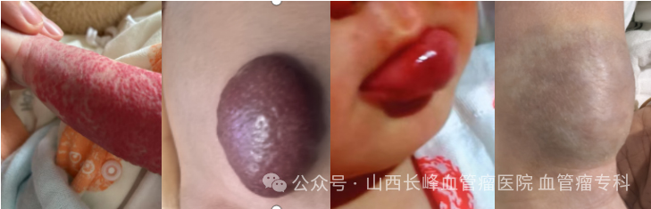 1 1