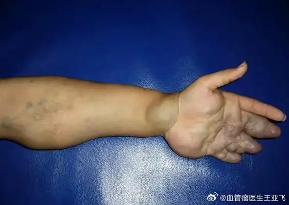 1 1