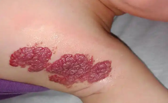 1 1