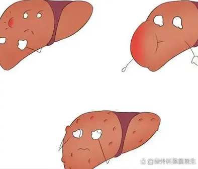 1 1