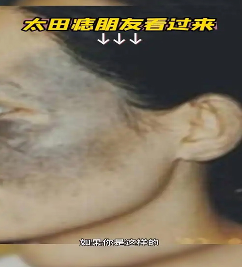 1 1