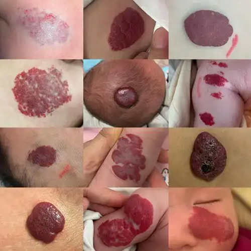 1 1