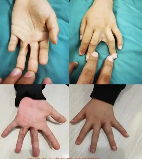 1 1