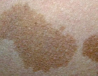 1 1