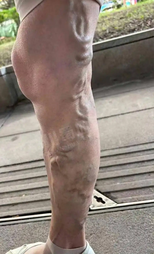 1 1