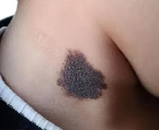 1 1
