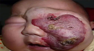 1 1