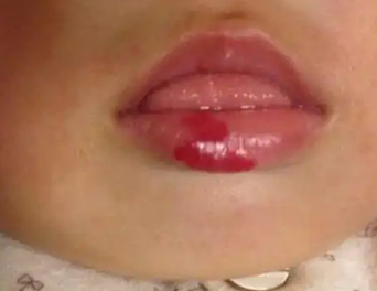 1 1