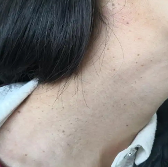 1 1