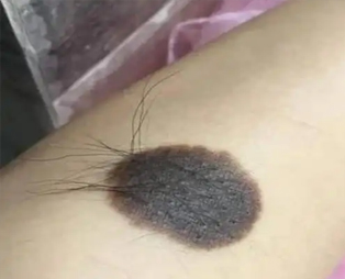 1 1