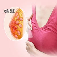 乳腺癌健康：女人一生必须关注的隐形挑战