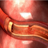 血管通络背后的“护航使者”